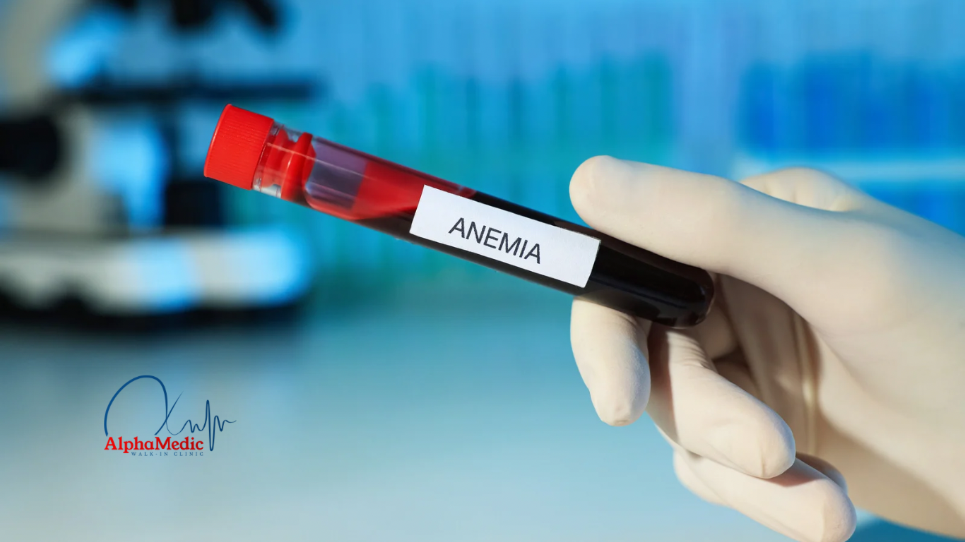 Sideropenična anemija: tihi uzrok umora koji se može učinkovito liječiti u AlphaMedic klinici